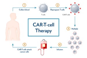 CAR T-Cell Therapy